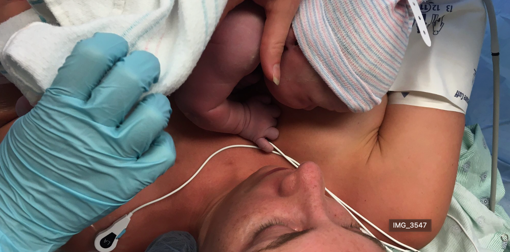 My Natural C-Section